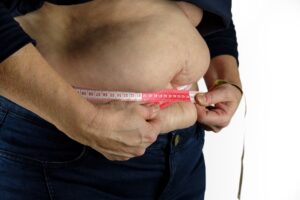 Obesity, gut health, microbes, fasting, calorie restriction